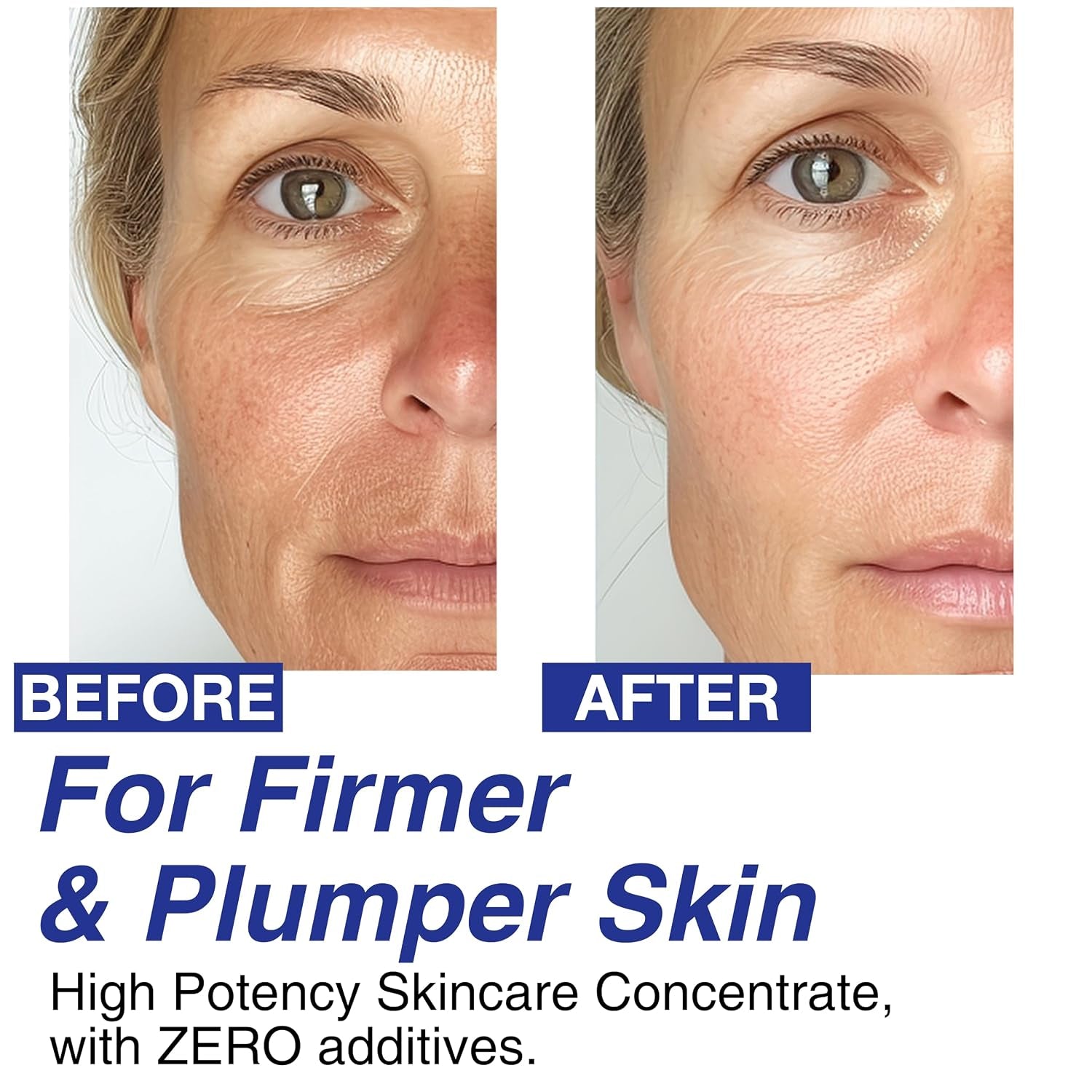Volufiline 100% Concentrate Firming Serum for Sagging Skin – Face Tightening, Jawline & V-Line Contour Booster, Anti-Wrinkle Collagen Enhancer | Fast-Absorbing Mix-In Korean Skincare
